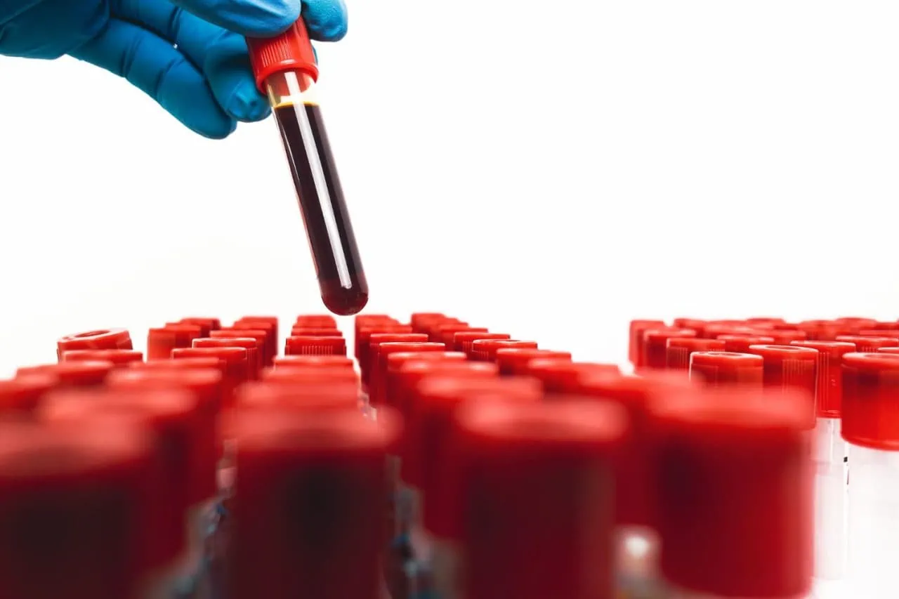 blood test sample tube with red cap is hand blue gloved doctor object isolated white background copy space hematology healthcare laboratory concept