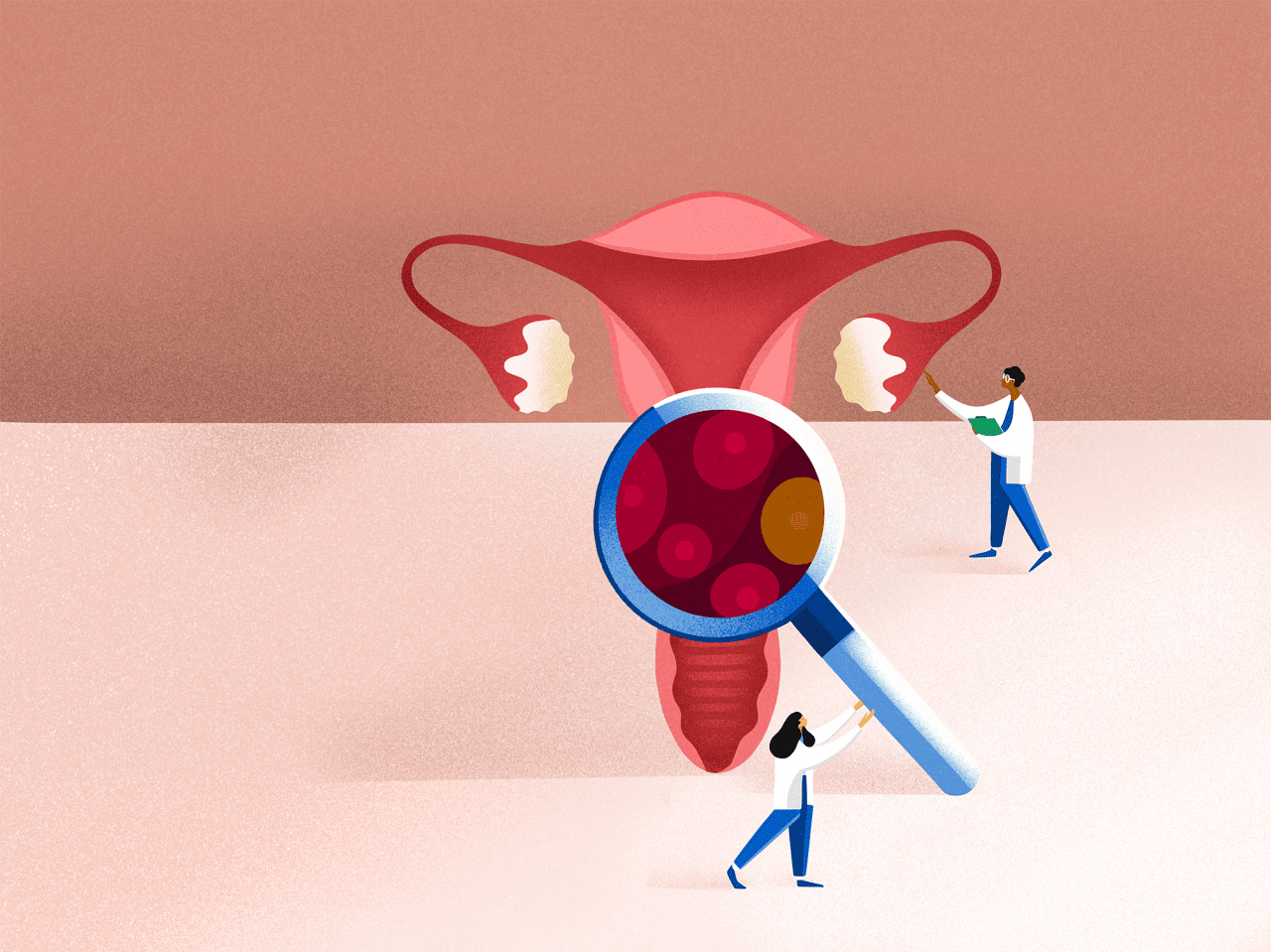 cancer type Cervial sml 1