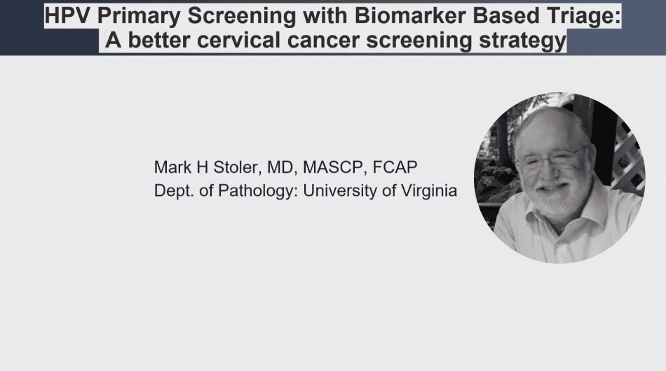 21st International Congress of Cytology HPV Primary Screening with Biomarker Based Triage A better cervical cancer screening strategy featured image