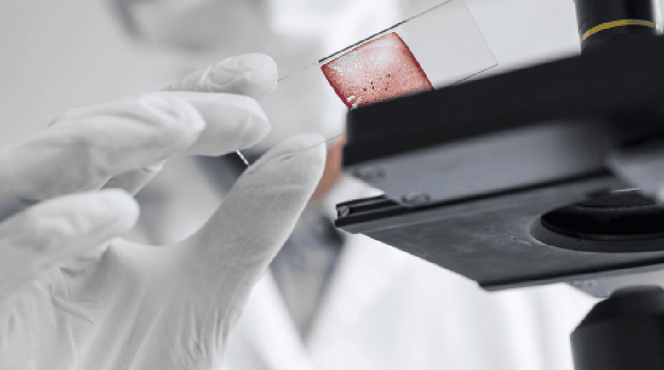 Recommendations for Use of p16 Ki67 Dual Stain for Management of Individuals Testing Positive for Human Papillomavirus featured image