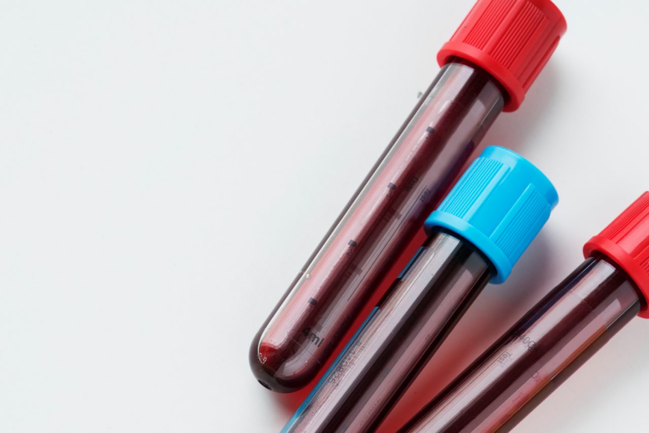 closeup blood tube test