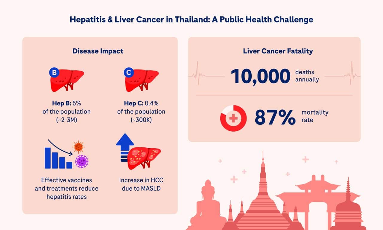 Graphic of liver disease in Thailand. Hepatitis B prevalence is 5% of the population (estimated 2 to 3 million people). Hepatitis C prevalence is 0.4% of the population (estimated 300 thousand people). Icons show effective vaccines and treatments have reduced hepatitis rates, but MASL linked HCC is on the rise. There are 10,000 liver cancer deaths annually, 87% mortality rate of liver cancer.